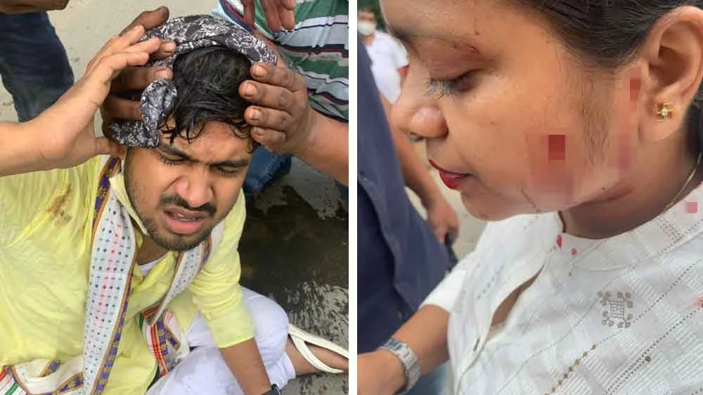 ত্রিপুরায় আক্রান্ত তৃণমূল নেতা দেবাংশু ভট্টাচার্য, মাথা ফাটল সুদীপ রাহার