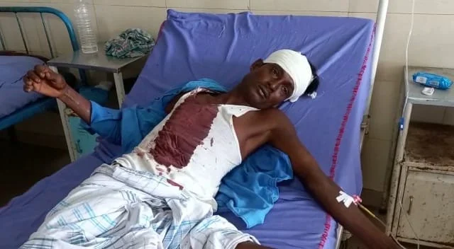 লক্ষ্মী ভান্ডারের ফর্ম দেওয়াকে ঘিরে তুলকালাম, চলল বোমাবাজি থেকে মারধর, আহত ২